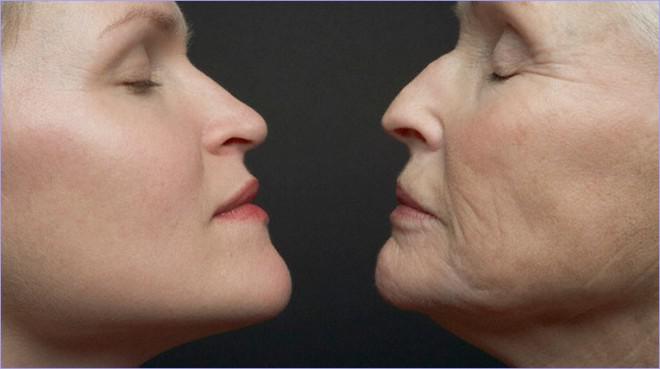 Старение кожи - главные секреты, как замедлить процесс старения