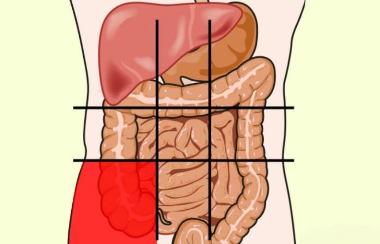 Боли в животе фото карта болей