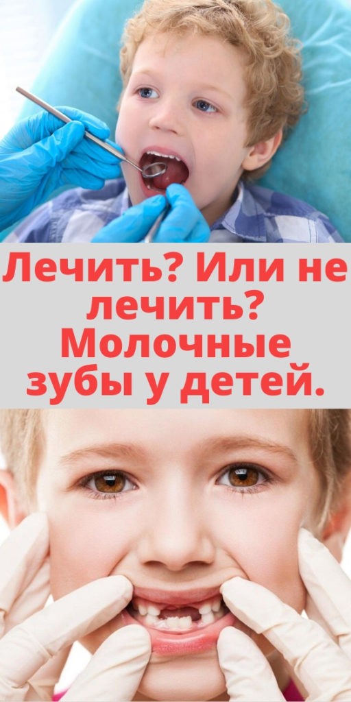 Лечить? Или не лечить? Молочные зубы у детей.