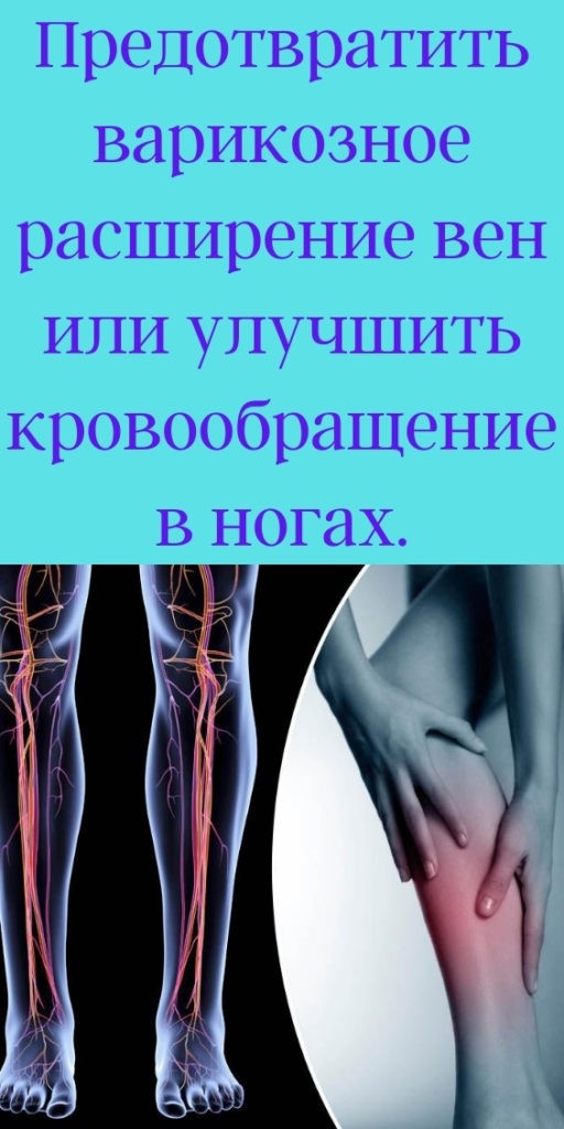 Предотвратить варикозное расширение вен или улучшить кровообращение в ногах.